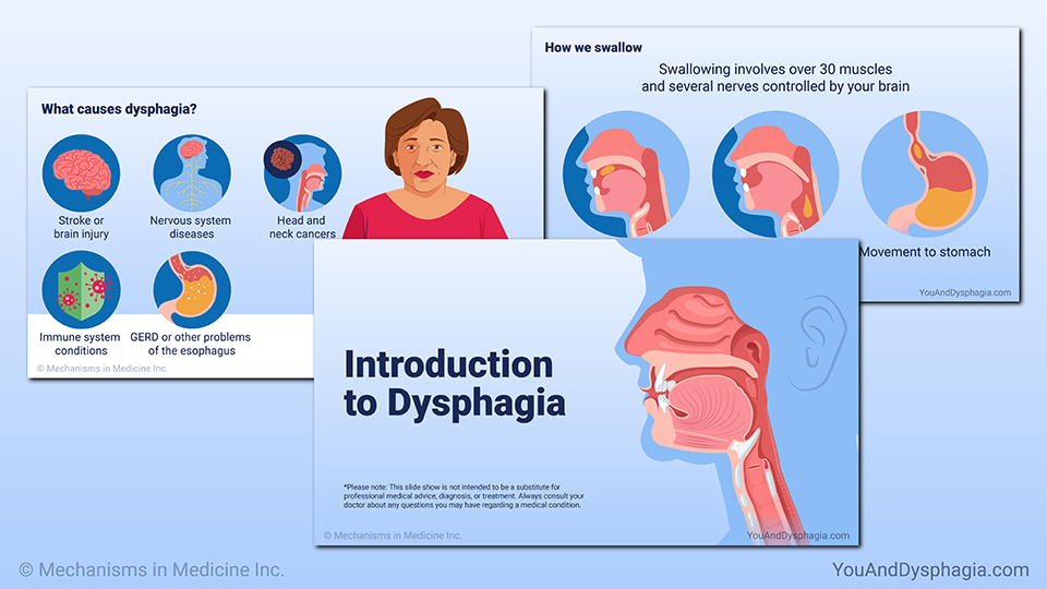 Introduction to Dysphagia — Slide Show
